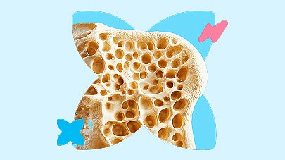 Скрининг гипофосфатазии
